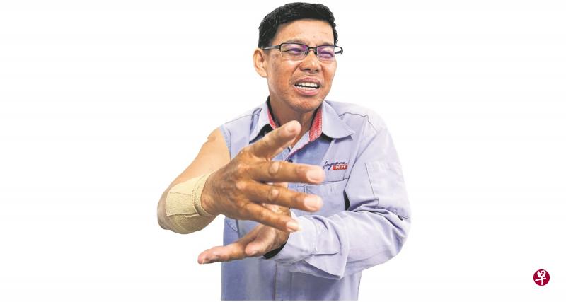 李健耀的右前臂被狗咬伤,却还坚持要送完信件,才通知公司。 李健耀的右前臂被狗咬伤,却还坚持要送完信件,才通知公司。