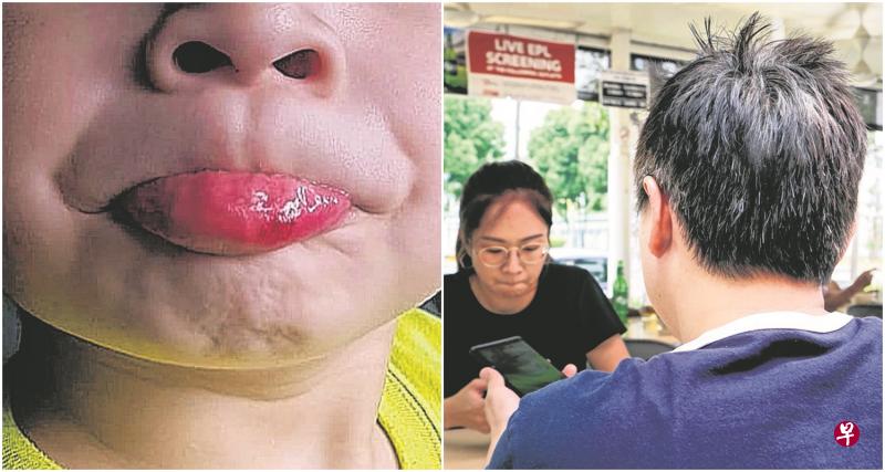 左图:陈先生指儿子遭同学一脚踢破嘴唇,受伤流血。(受访者提供)右图:陈先生日前受访,向记者绘述儿子遭同学霸凌,老师视而不见的经过。(严宣融摄) 左图:陈先生指儿子遭同学一脚踢破嘴唇,受伤流血。(受访者提供)右图:陈先生日前受访,向记者绘述儿子遭同学霸凌,老师视而不见的经过。(严宣融摄)
