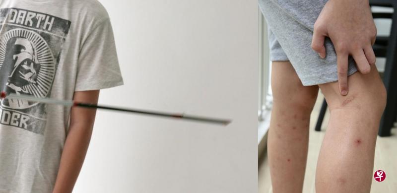 小六男生申诉与同学起冲突后遭训导主任施以体罚。 小六男生申诉与同学起冲突后遭训导主任施以体罚。