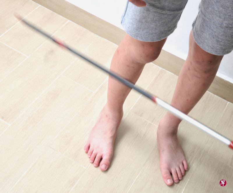 江女士和丈夫发现念小学六年级的儿子被训导主任鞭打后,已向教育部投诉,并报警处理。(陈佩敏摄) 江女士和丈夫发现念小学六年级的儿子被训导主任鞭打后,已向教育部投诉,并报警处理。(陈佩敏摄)