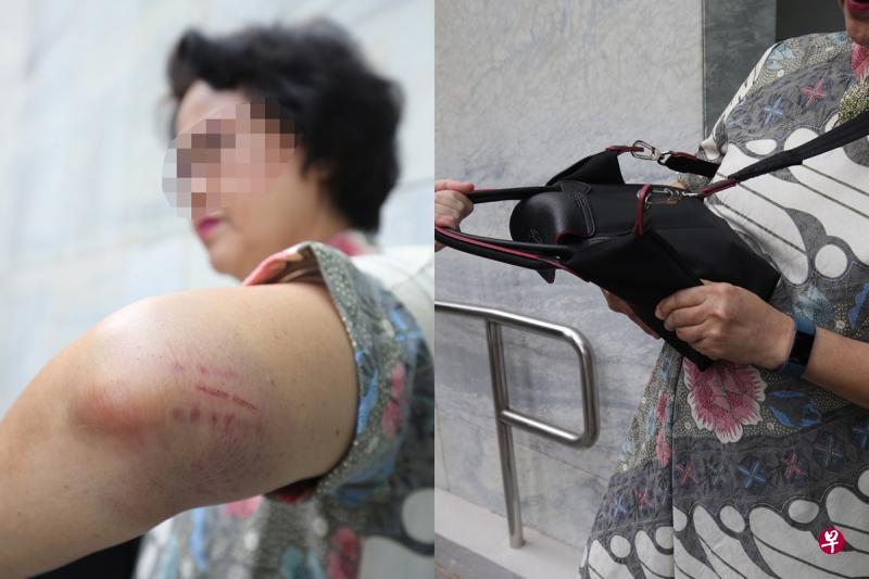 新加坡妇女到马国出席婚礼,在亲戚家门前被匪徒持巴冷刀抢劫,手脚擦伤。 (唐家鸿摄) 新加坡妇女到马国出席婚礼,在亲戚家门前被匪徒持巴冷刀抢劫,手脚擦伤。 (唐家鸿摄)