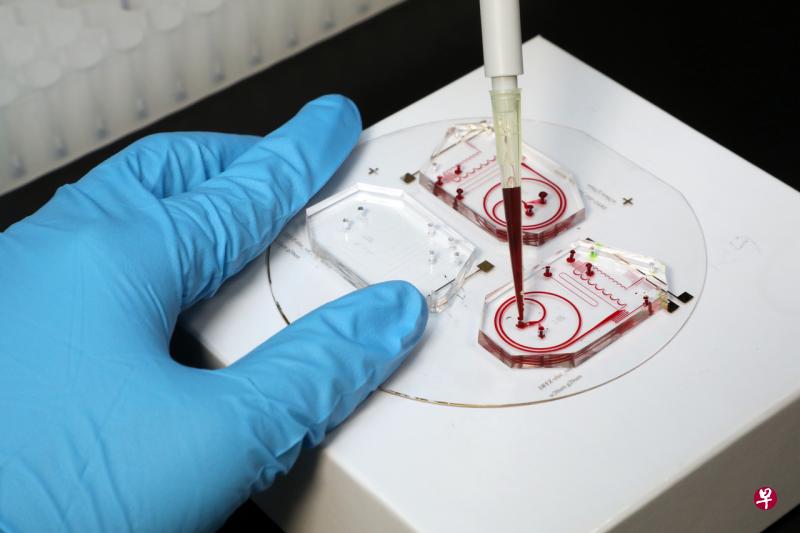 南洋理工大学研发的晶片可隔离和分析白血球,研究人员希望能在两三年后推出市场。(邝启聪摄) 南洋理工大学研发的晶片可隔离和分析白血球,研究人员希望能在两三年后推出市场。(邝启聪摄)