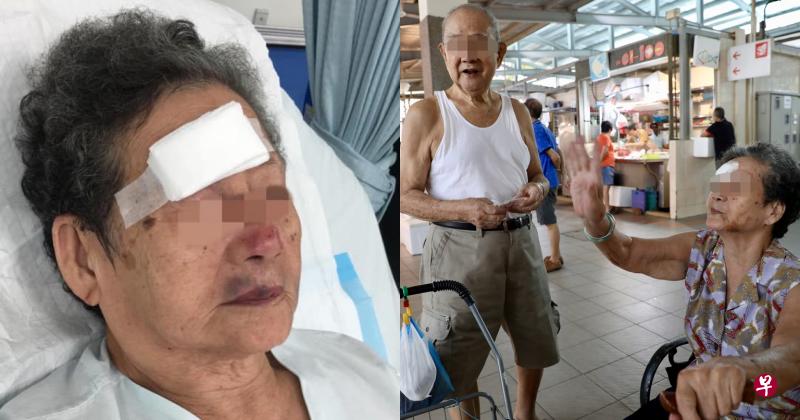 (左图)阿嫲右眉处缝了七针,鼻子和嘴唇都有淤青。(右图)八旬阿嫲杨来春和丈夫今早又一同到巴刹走走,说自己当天遭绊倒后,撞到手推车的手把受伤。(取自面簿/邝启聪摄) (左图)阿嫲右眉处缝了七针,鼻子和嘴唇都有淤青。(右图)八旬阿嫲杨来春和丈夫今早又一同到巴刹走走,说自己当天遭绊倒后,撞到手推车的手把受伤。(取自面簿/邝启聪摄)