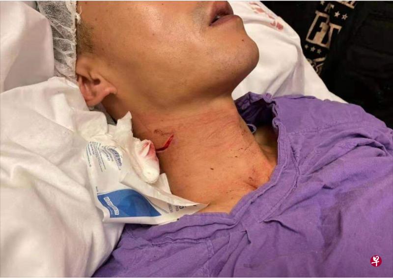 被示威者割伤颈部的香港警员正在医院接受治疗。(读者提供) 被示威者割伤颈部的香港警员正在医院接受治疗。(读者提供)