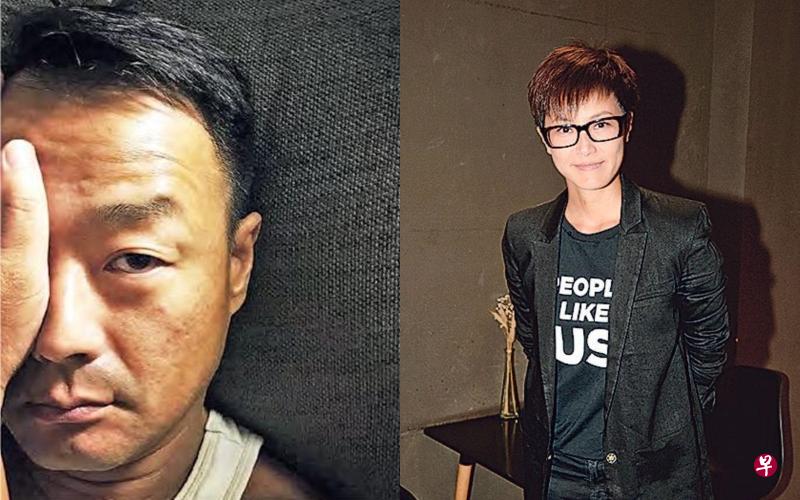 王喜(左图)和何韵诗在社媒谴责香港警方向示威男子开枪。(互联网) 王喜(左图)和何韵诗在社媒谴责香港警方向示威男子开枪。(互联网)