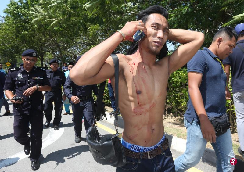 一名男子在冲突中被石头击中头部受伤流血,被警察带离现场。(中国报) 一名男子在冲突中被石头击中头部受伤流血,被警察带离现场。(中国报)