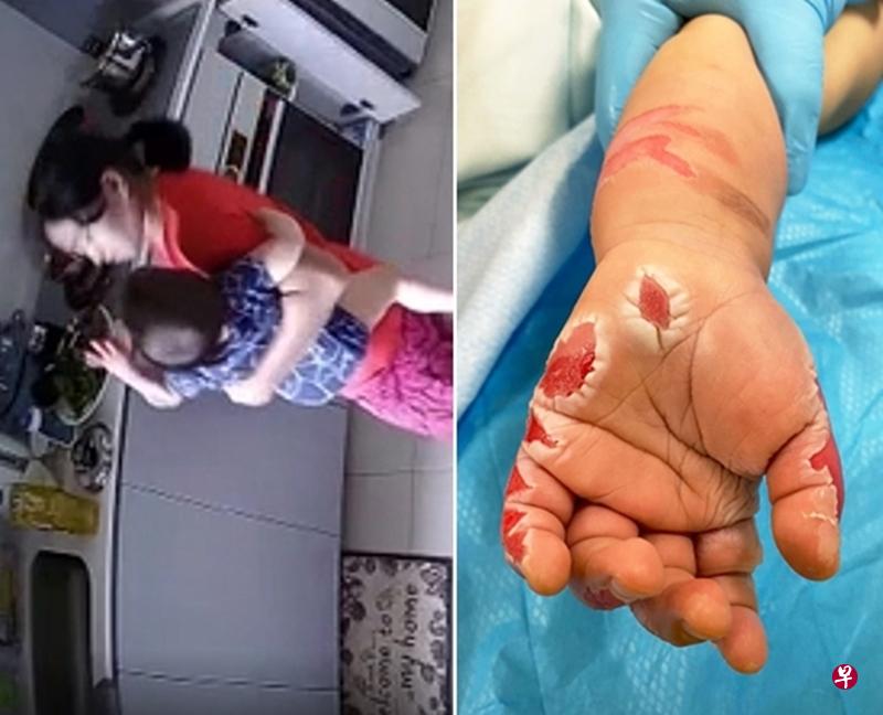 女佣拉17个月大女婴的手进热锅4次。(取自面簿) 女佣拉17个月大女婴的手进热锅4次。(取自面簿)