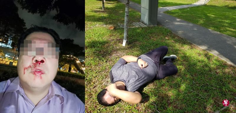 左图:卢传杰表示被一骑士殴打致满脸鲜血。(受访者提供)右图:卢传杰示范自己被打到倒地的情况。(摄影/蔡振鸿) 左图:卢传杰表示被一骑士殴打致满脸鲜血。(受访者提供)右图:卢传杰示范自己被打到倒地的情况。(摄影/蔡振鸿)