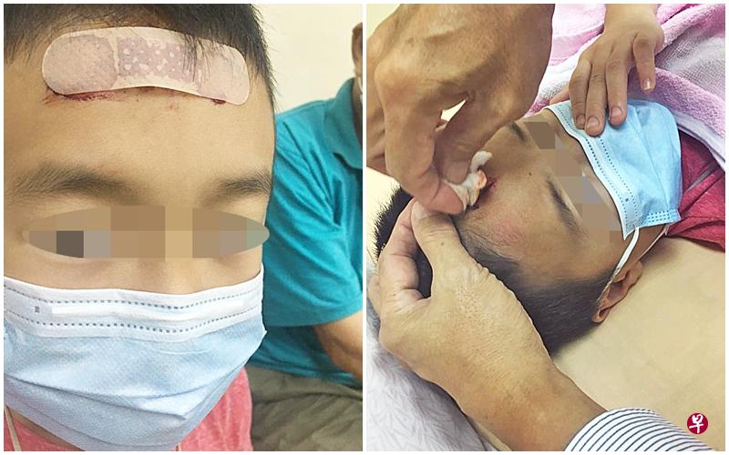 男童在托管中心撞到木门角,额头出现2公分伤口, 血流不止。(受访者提供) 男童在托管中心撞到木门角,额头出现2公分伤口, 血流不止。(受访者提供)