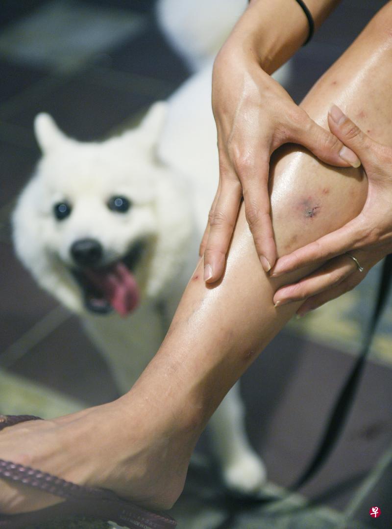 女演员膝盖受伤,她已报警处理。(蔡振鸿摄) 女演员膝盖受伤,她已报警处理。(蔡振鸿摄)