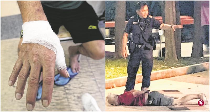 左图:水果店助手王先生为了阻止男子偷钱,尝试将他压制在地,结果混乱中拇指当场骨折。(饶进礼摄)右图:男子被四名男子制伏,警员到场后将他上手铐逮捕。(受访者提供) 左图:水果店助手王先生为了阻止男子偷钱,尝试将他压制在地,结果混乱中拇指当场骨折。(饶进礼摄)右图:男子被四名男子制伏,警员到场后将他上手铐逮捕。(受访者提供)