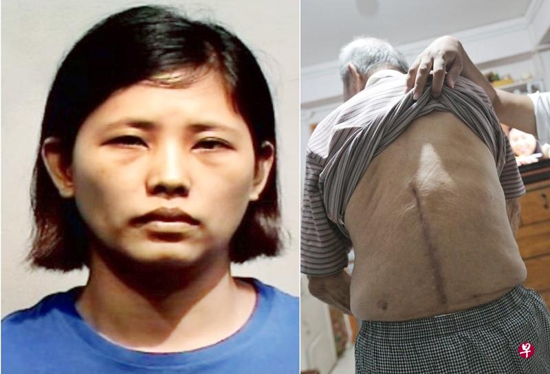 92岁老雇主事后动手术,至今仍未康复。(徐颖荃摄) 92岁老雇主事后动手术,至今仍未康复。(徐颖荃摄)