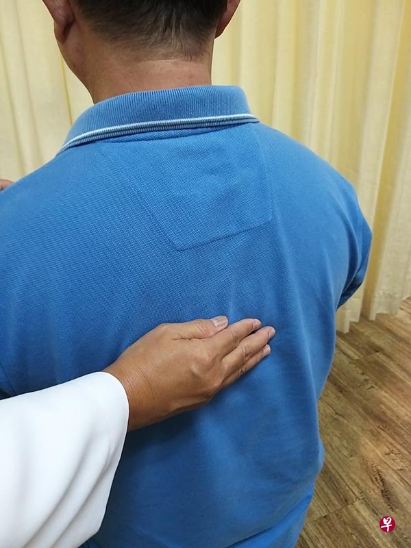 多数人都可通过拍背排痰,但一些患者需要专业医疗人员来进行。(受访者提供) 多数人都可通过拍背排痰,但一些患者需要专业医疗人员来进行。(受访者提供)