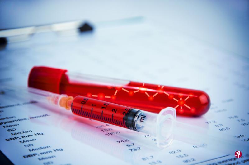 血友病是由于缺乏正常水平的凝血因子所导致的出血问题,一般可通过血液测试来诊断。(iStock图片) 血友病是由于缺乏正常水平的凝血因子所导致的出血问题,一般可通过血液测试来诊断。(iStock图片)