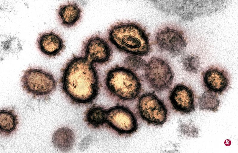 意大利科学家在空气污染的悬浮粒子发现冠病病毒,这可能意味空气污染愈严重的地区,冠病感染率愈高。(路透社) 意大利科学家在空气污染的悬浮粒子发现冠病病毒,这可能意味空气污染愈严重的地区,冠病感染率愈高。(路透社)