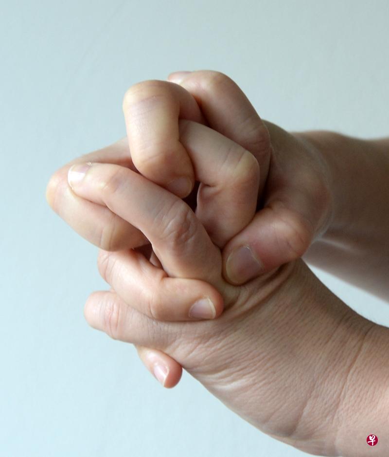 家属应留意失智症患者在这期间的情绪。(档案照) 家属应留意失智症患者在这期间的情绪。(档案照)