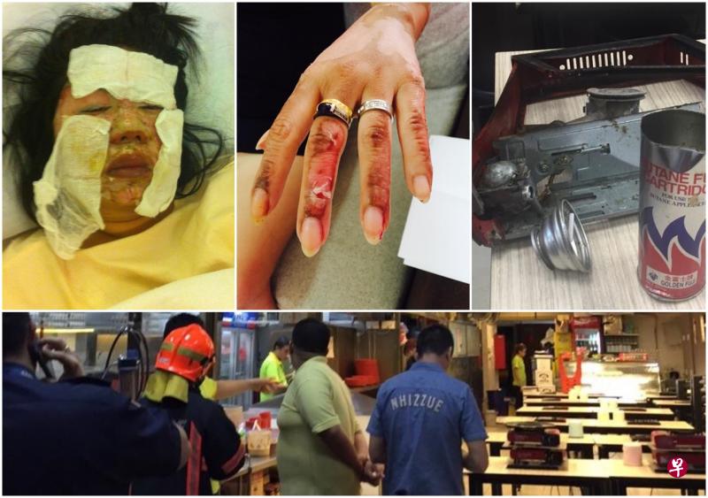 事发后余秀甄的脸部严重受伤,医护人员过后在她的脸敷上一片保护膜,过后为脸部进行植皮。如今脸部不能晒太阳和化妆,她也因此很少出门。(受访者提供) 事发后余秀甄的脸部严重受伤,医护人员过后在她的脸敷上一片保护膜,过后为脸部进行植皮。如今脸部不能晒太阳和化妆,她也因此很少出门。(受访者提供)