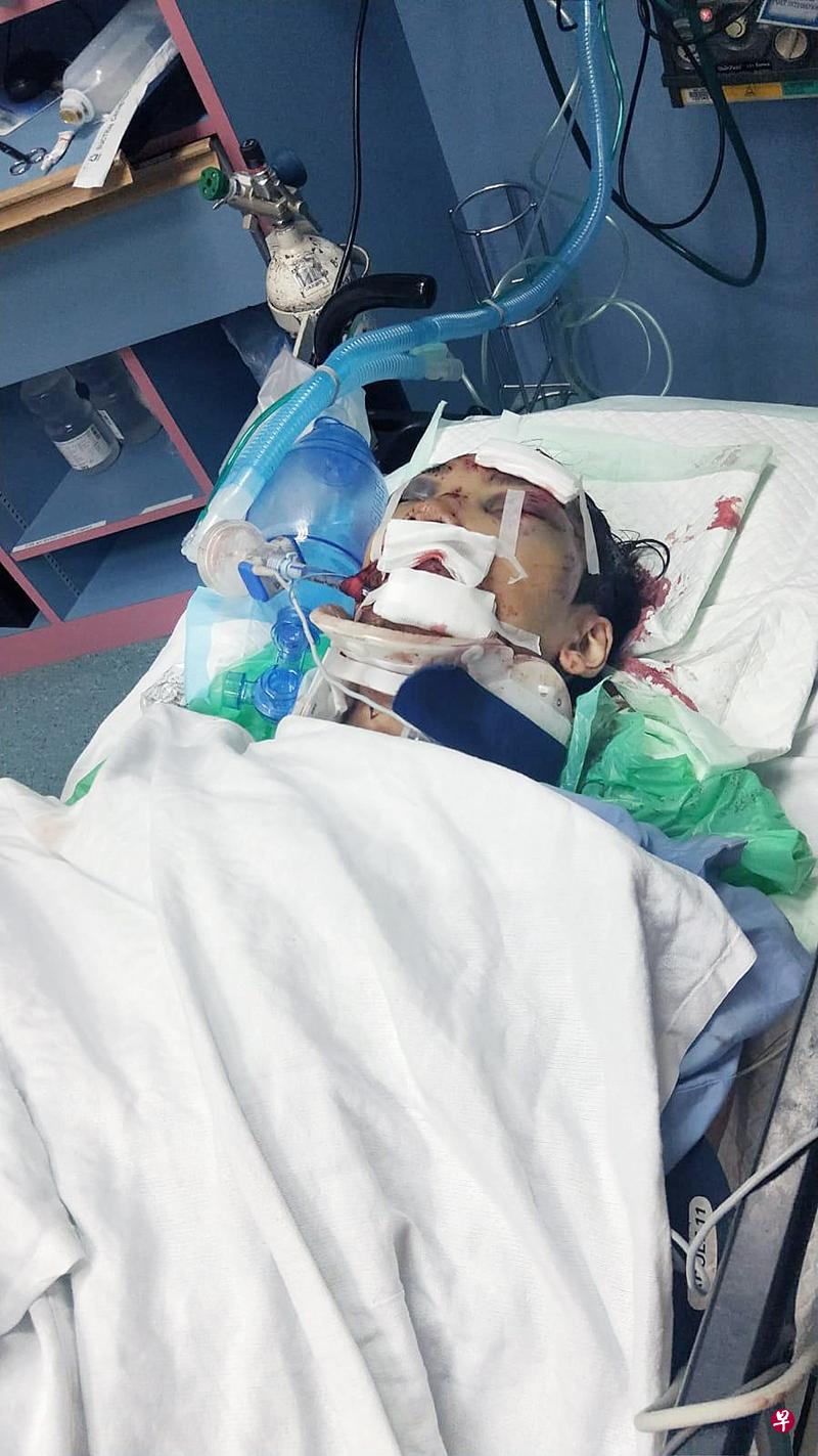 送餐员沙易车祸后重伤入院,目前仍昏迷不醒。(受访者提供) 送餐员沙易车祸后重伤入院,目前仍昏迷不醒。(受访者提供)