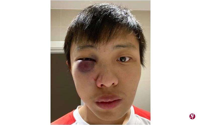 在英国伦敦留学的莫显强今年2月24日晚上在街上被袭击,其中一名涉嫌袭击的15岁少年之后被控上法庭。(互联网) 在英国伦敦留学的莫显强今年2月24日晚上在街上被袭击,其中一名涉嫌袭击的15岁少年之后被控上法庭。(互联网)