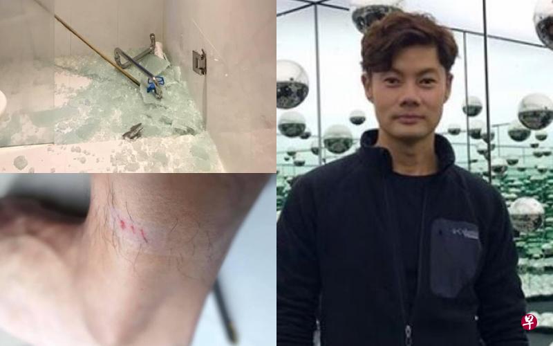 左图:杨君伟家中浴室玻璃碎了一地,让人触目惊心。(取自面簿)右图:杨君伟至今仍心有余悸。(档案照) 左图:杨君伟家中浴室玻璃碎了一地,让人触目惊心。(取自面簿)右图:杨君伟至今仍心有余悸。(档案照)