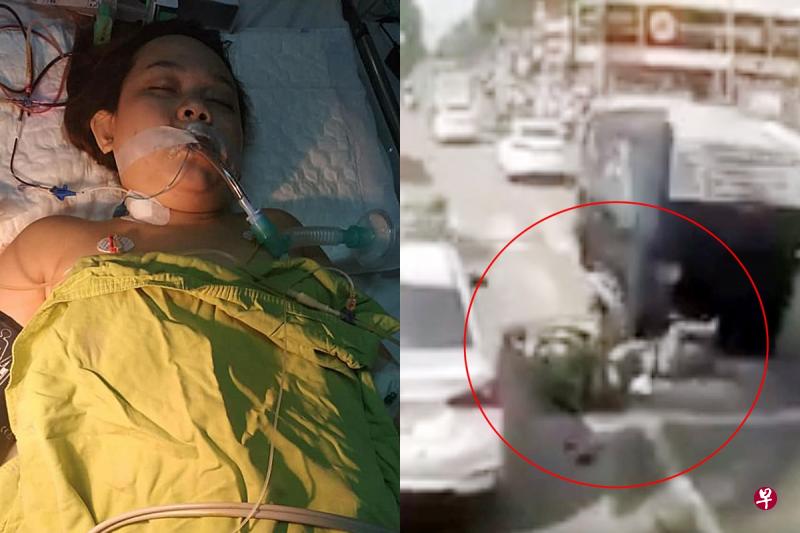 潘氏金支上周四在越南遇车祸,被罗厘碾过腰部,导致内脏破裂;潘氏金支受重伤后,在医院昏迷一周,终于在昨天下午苏醒。(受访者提供) 潘氏金支上周四在越南遇车祸,被罗厘碾过腰部,导致内脏破裂;潘氏金支受重伤后,在医院昏迷一周,终于在昨天下午苏醒。(受访者提供)