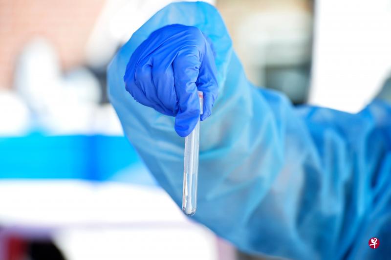一项针对3000名18至34岁住院患者的研究显示,患有病态肥胖、糖尿病和高血压等潜在病症的年轻人最有可能需要使用呼吸机或死于冠病。(法新社)
一项针对3000名18至34岁住院患者的研究显示,患有病态肥胖、糖尿病和高血压等潜在病症的年轻人最有可能需要使用呼吸机或死于冠病。(法新社)