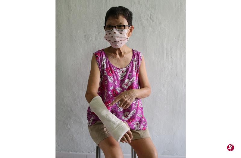 许月云右手被狗咬伤后,就一直联络不上女狗主。(李健玮摄) 许月云右手被狗咬伤后,就一直联络不上女狗主。(李健玮摄)