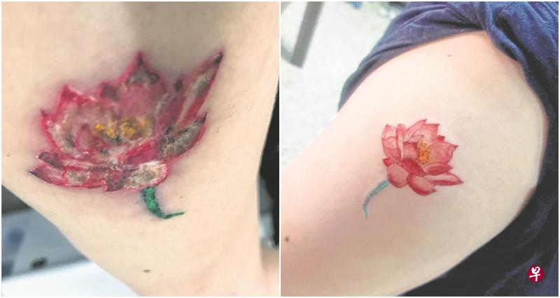 (左图)女子文身后,发现伤口处开始结痂和脱皮,莲花犹如枯萎凋零。(右图)麦基为女子刺莲花文身,文身刚被刺好时,莲花颜色鲜艳。(受访者提供) (左图)女子文身后,发现伤口处开始结痂和脱皮,莲花犹如枯萎凋零。(右图)麦基为女子刺莲花文身,文身刚被刺好时,莲花颜色鲜艳。(受访者提供)