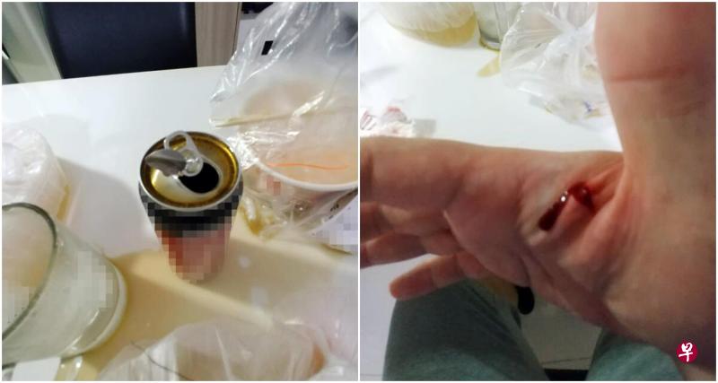 汽水罐突然“炸”开,衔接着拉环的铁片掀开后割伤曾先生的右手掌心。(受访者提供) 汽水罐突然“炸”开,衔接着拉环的铁片掀开后割伤曾先生的右手掌心。(受访者提供)