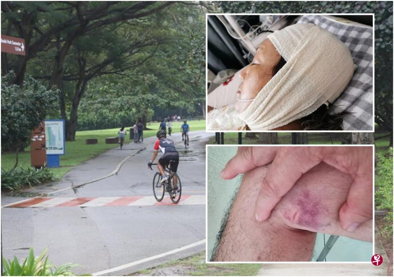 刘先生脚部被撞伤,太太摔倒在地,头部缝了五针。(受访者提供) 刘先生脚部被撞伤,太太摔倒在地,头部缝了五针。(受访者提供)