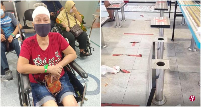 坐着的长椅凳板突然松脱,导致66岁的阿嫂往后仰,后脑勺撞到咖啡店的椅子,头部过后被包扎起来。(受访者提供) 坐着的长椅凳板突然松脱,导致66岁的阿嫂往后仰,后脑勺撞到咖啡店的椅子,头部过后被包扎起来。(受访者提供)