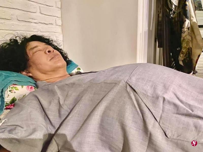 比利发病时腹部肿胀如铜锣 。 比利发病时腹部肿胀如铜锣 。