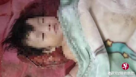中国河北石家庄一名四个月大的女婴两度坠楼,父亲却不屑一顾,不让女儿留院治疗,坚称带回家“养养就好了”。(互联网) 中国河北石家庄一名四个月大的女婴两度坠楼,父亲却不屑一顾,不让女儿留院治疗,坚称带回家“养养就好了”。(互联网)