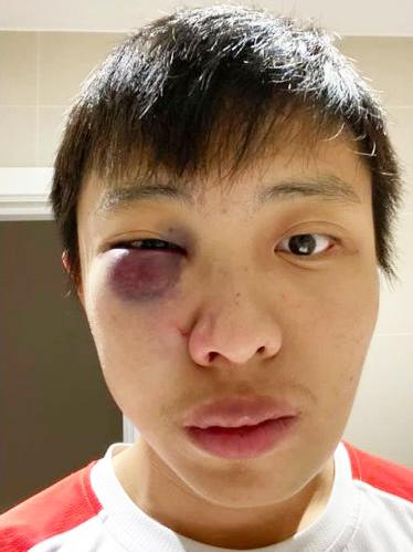 留学生莫显强在伦敦街头遭袭击。(档案照) 留学生莫显强在伦敦街头遭袭击。(档案照)