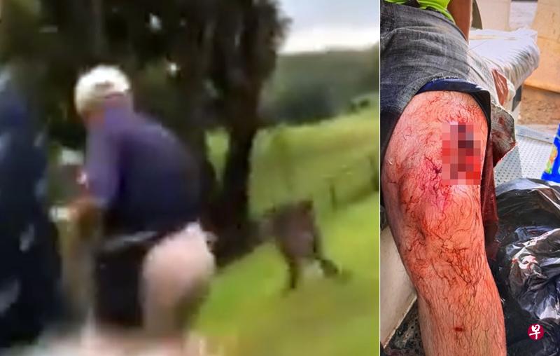 俱乐部群组流传一张照片,相信就是承包商被野猪袭击后的伤势照。(读者提供) 俱乐部群组流传一张照片,相信就是承包商被野猪袭击后的伤势照。(读者提供)