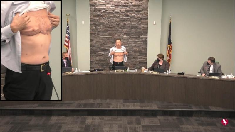 美国华裔地方官员王力(音译,右三)上周在会议上,当众展示他在美国服役期间胸部受伤所留下的大伤疤,以回应外界质疑他的爱国心。(West Chester Vimeo视频截图) 美国华裔地方官员王力(音译,右三)上周在会议上,当众展示他在美国服役期间胸部受伤所留下的大伤疤,以回应外界质疑他的爱国心。(West Chester Vimeo视频截图)